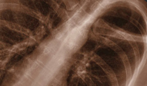 International Consultancy